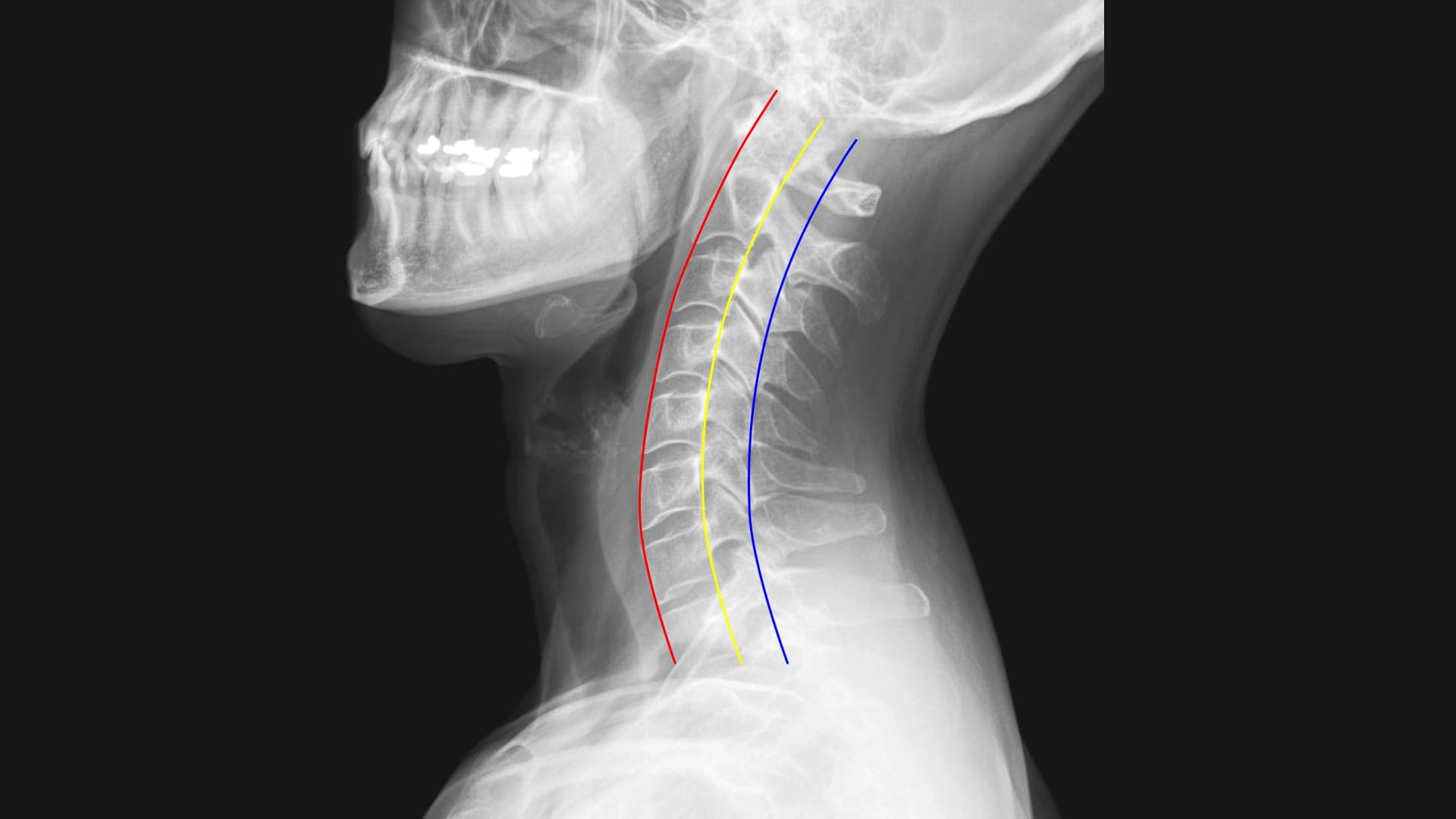 Precision Medicine, Precise Data: A Guide to Annotation Requirements for Medical AI with Scematics